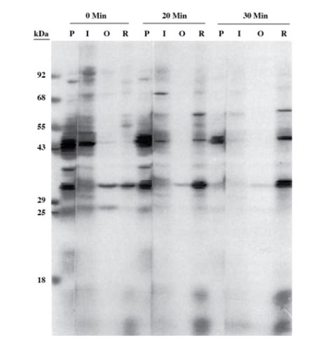 tpr test reddit